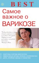 Книга - Ирина Сергеевна Малышева - Самое важное о варикозе (fb2) читать без регистрации