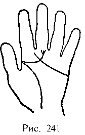 Закон ы научного чтения руки. Вильям Бенхем. Иллюстрация 404